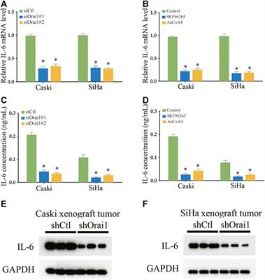 Orai1-mediated store-operated Ca2+ entry promotes cervical cancer progression through IL-6 signaling